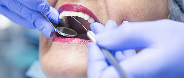 Best Same-Day Emergency Dental Services in Roodhouse, IL